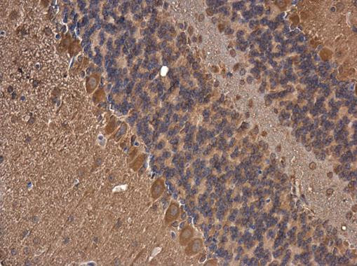 FASN Antibody in Immunohistochemistry (Paraffin) (IHC (P))