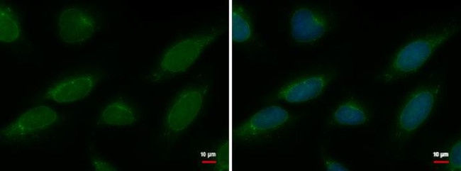 NUP62 Antibody in Immunocytochemistry (ICC/IF)