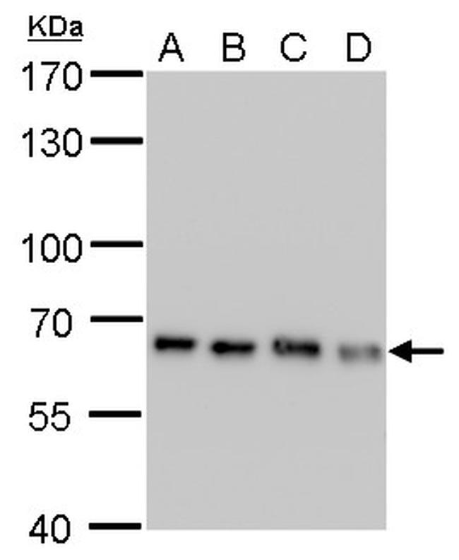 NUP62 Antibody in Western Blot (WB)