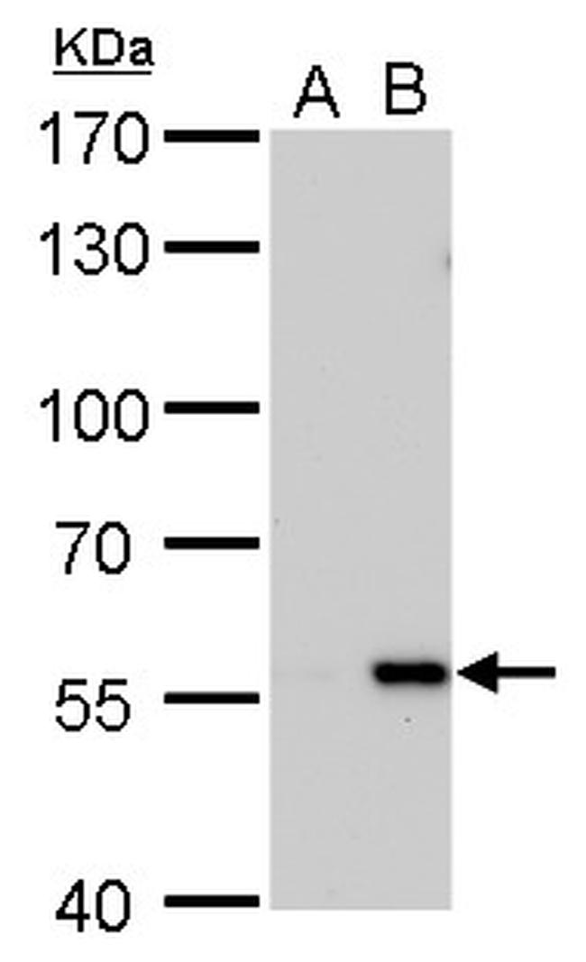 Carbonic Anhydrase IX Antibody in Western Blot (WB)