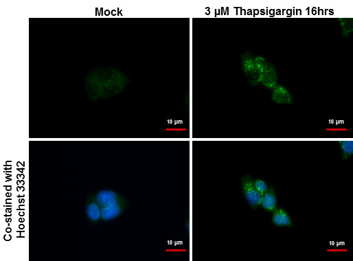 SQSTM1 Antibody in Immunocytochemistry (ICC/IF)