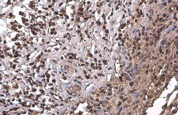 PRMT1 Antibody in Immunohistochemistry (Paraffin) (IHC (P))