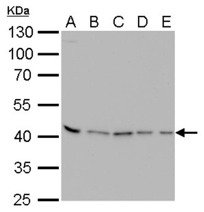 PRMT1 Antibody in Western Blot (WB)