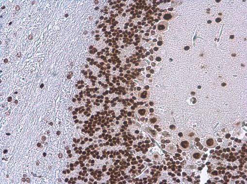 TDP-43 Antibody in Immunohistochemistry (Paraffin) (IHC (P))