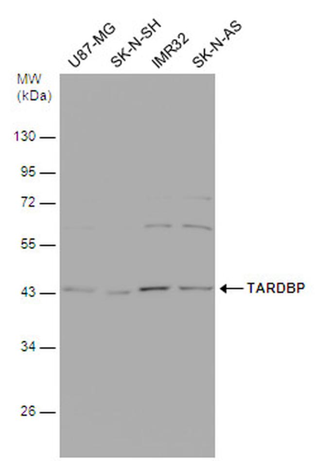 TDP-43 Antibody in Western Blot (WB)