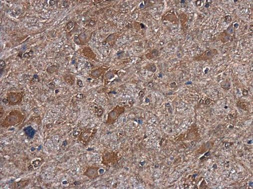 mTOR Antibody in Immunohistochemistry (Paraffin) (IHC (P))