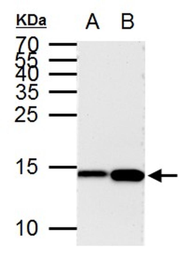 H3K9ac Antibody in Western Blot (WB)