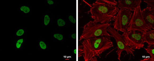 H3K9ac Antibody in Immunocytochemistry (ICC/IF)