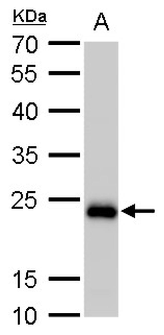 SOD2 Antibody in Western Blot (WB)