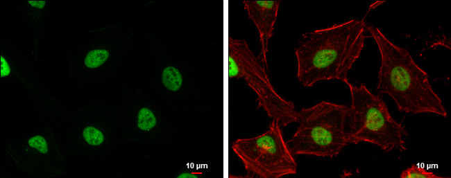 USP7 Antibody in Immunocytochemistry (ICC/IF)