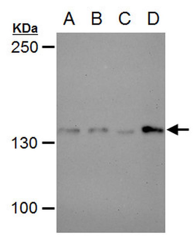 USP7 Antibody in Western Blot (WB)