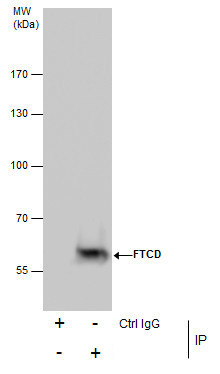 Golgi protein 58k Antibody in Immunoprecipitation (IP)