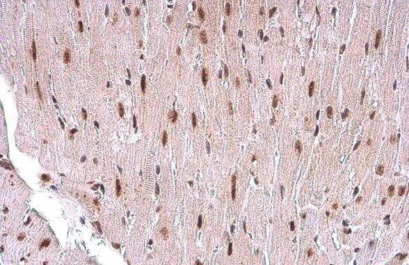 TDG Antibody in Immunohistochemistry (Paraffin) (IHC (P))