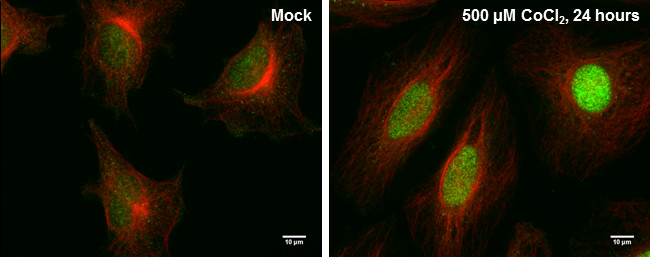 HIF-2 alpha Antibody in Immunocytochemistry (ICC/IF)