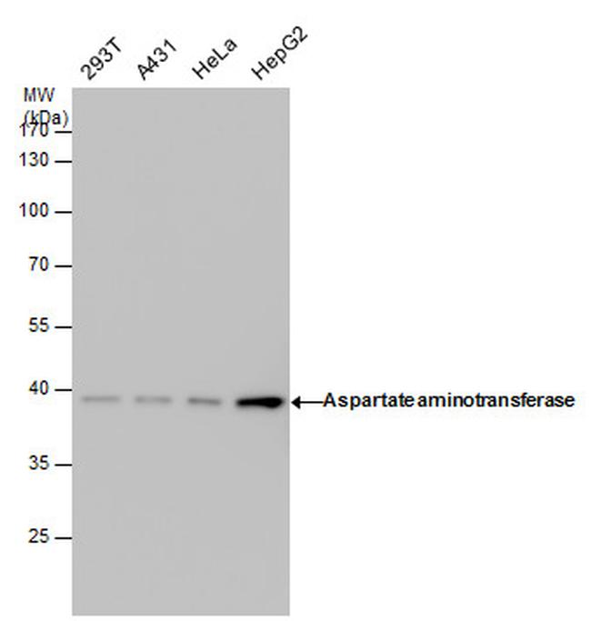 GOT1 Antibody in Western Blot (WB)