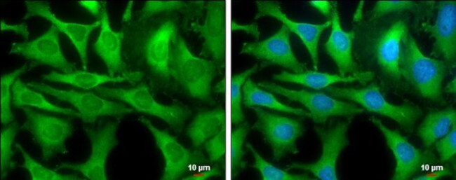 GOT1 Antibody in Immunocytochemistry (ICC/IF)