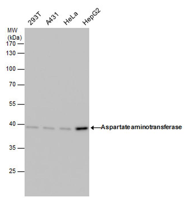 GOT1 Antibody in Western Blot (WB)