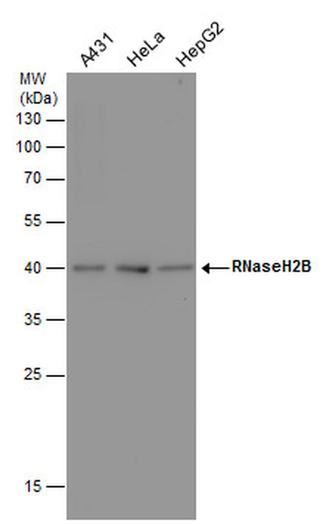 RNaseH2B Antibody in Western Blot (WB)