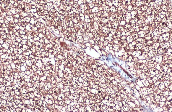 UCP1 Antibody in Immunohistochemistry (Paraffin) (IHC (P))