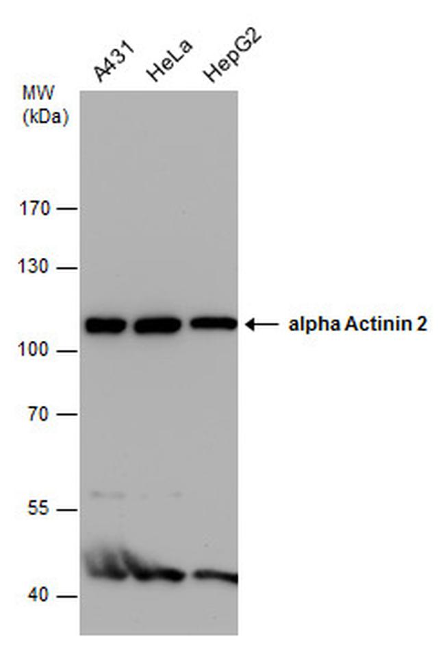 alpha Actinin 2 Antibody in Western Blot (WB)