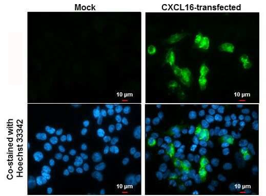 CXCL16 Antibody in Immunocytochemistry (ICC/IF)