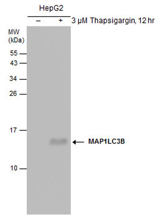 LC3B Antibody in Western Blot (WB)