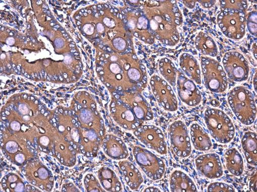 Filamin B Antibody in Immunohistochemistry (Paraffin) (IHC (P))