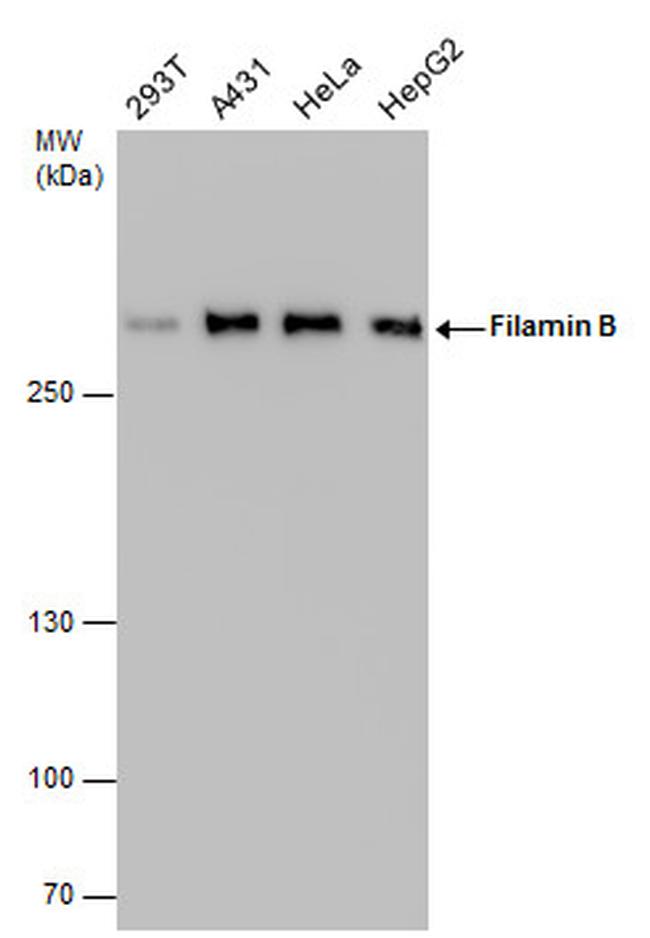 Filamin B Antibody in Western Blot (WB)