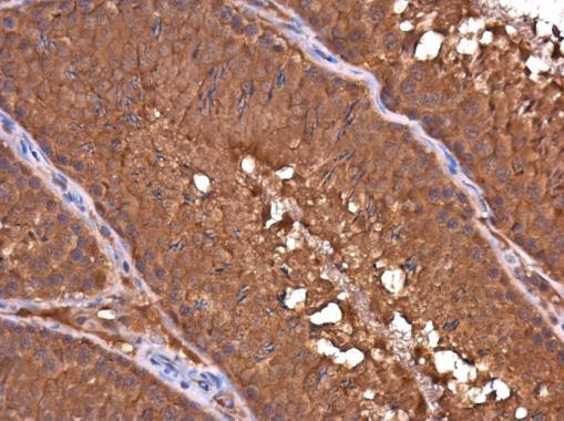 DAPP1 Antibody in Immunohistochemistry (Paraffin) (IHC (P))