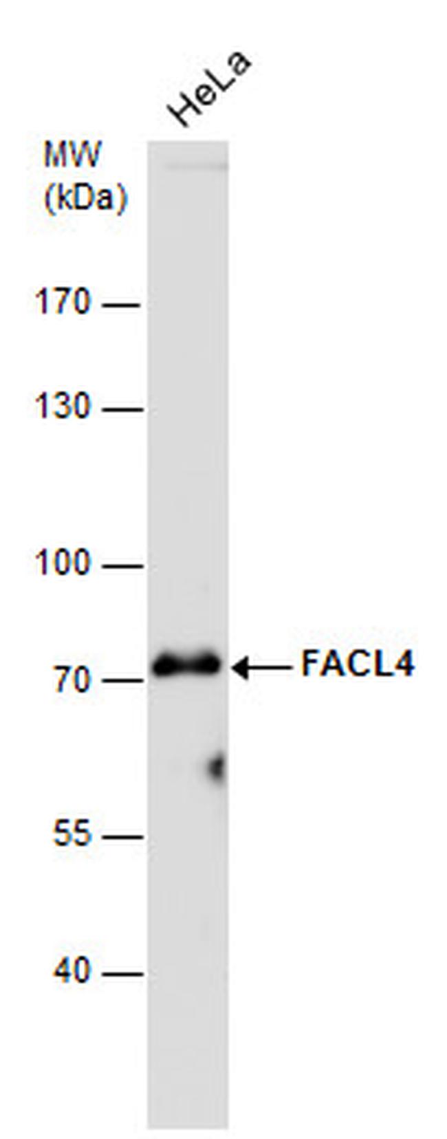 ACSL4 Antibody in Western Blot (WB)