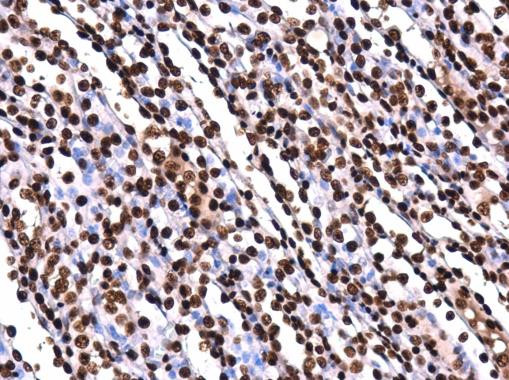 H2AK5ac Antibody in Immunohistochemistry (Paraffin) (IHC (P))