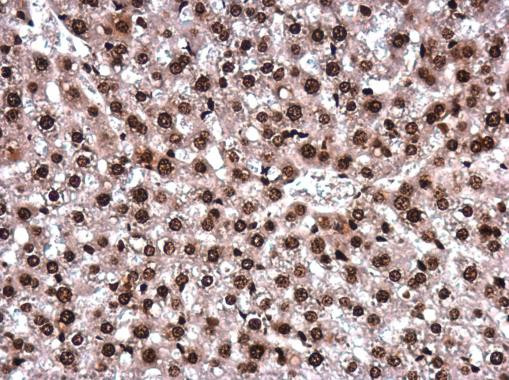 H2AK5ac Antibody in Immunohistochemistry (Paraffin) (IHC (P))