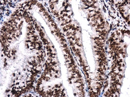 BRG1 Antibody in Immunohistochemistry (Paraffin) (IHC (P))