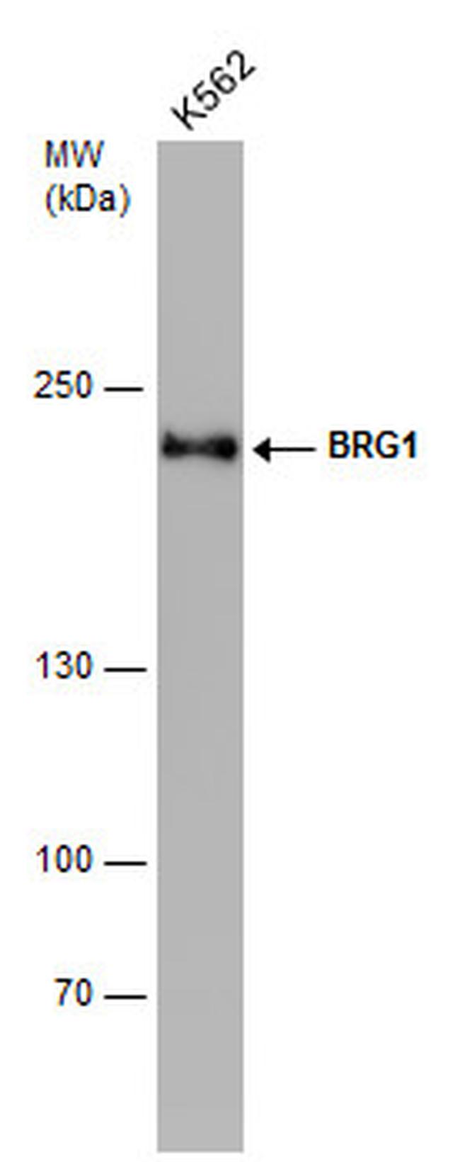 BRG1 Antibody in Western Blot (WB)