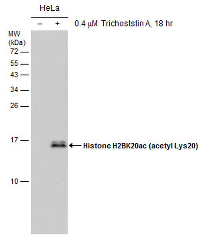 H2BK20ac Antibody in Western Blot (WB)