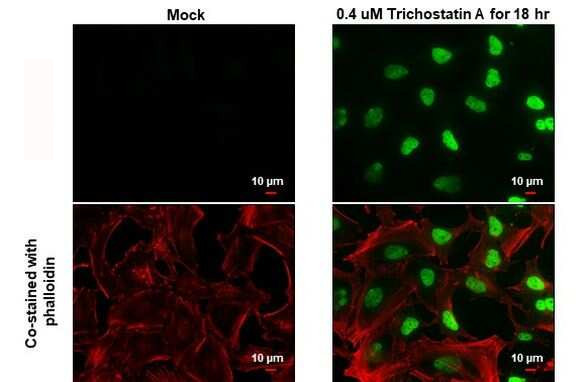 H2BK20ac Antibody in Immunocytochemistry (ICC/IF)