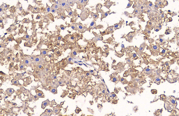 Glypican 3 Antibody in Immunohistochemistry (Paraffin) (IHC (P))