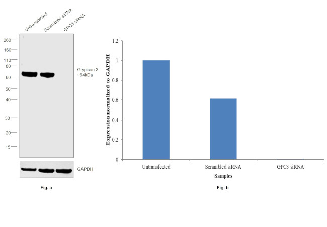 Glypican 3 Antibody