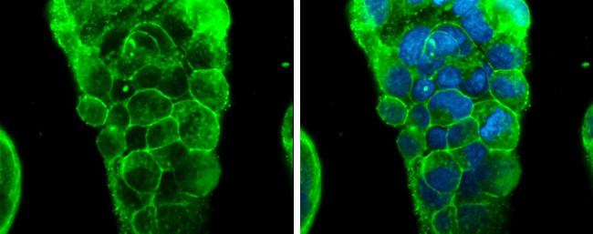 Glypican 3 Antibody in Immunocytochemistry (ICC/IF)