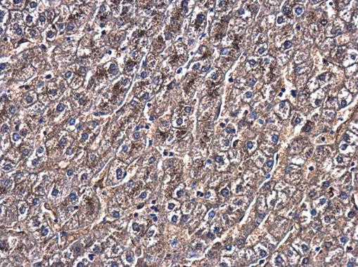 Glypican 3 Antibody in Immunohistochemistry (Paraffin) (IHC (P))