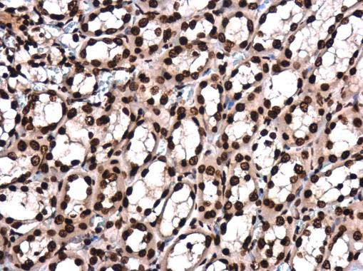 H4K8ac Antibody in Immunohistochemistry (Paraffin) (IHC (P))