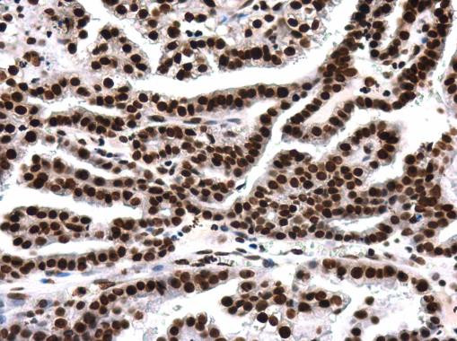 H4K8ac Antibody in Immunohistochemistry (Paraffin) (IHC (P))