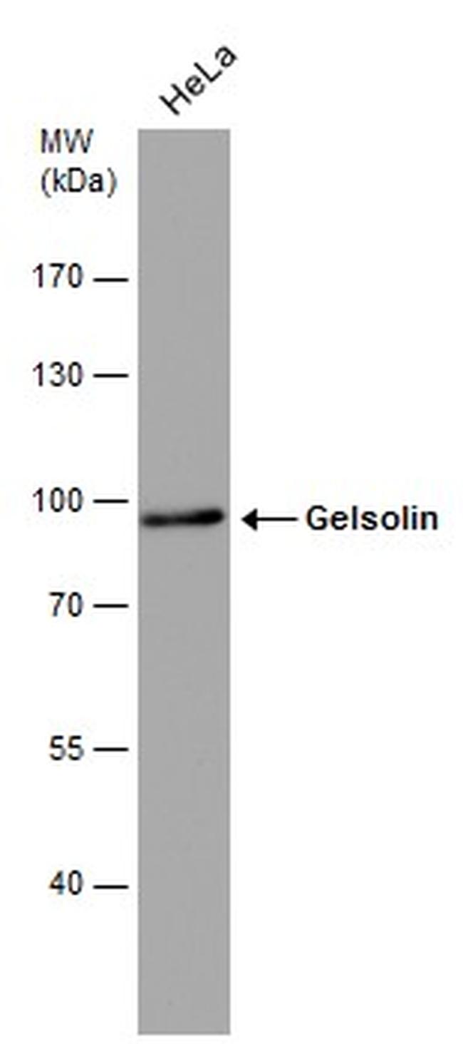 Gelsolin Antibody in Western Blot (WB)