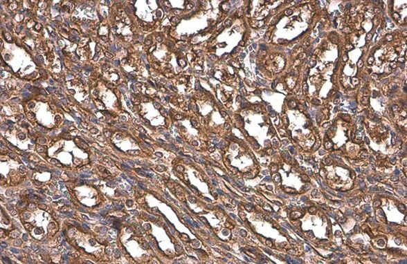 Paxillin Antibody in Immunohistochemistry (Paraffin) (IHC (P))