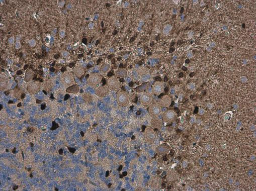 QKI Antibody in Immunohistochemistry (Paraffin) (IHC (P))