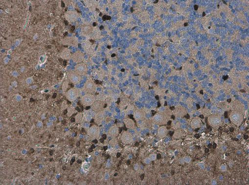 QKI Antibody in Immunohistochemistry (Paraffin) (IHC (P))