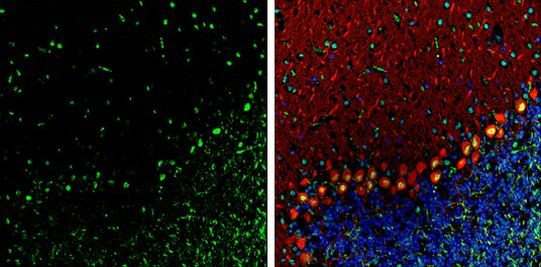 TDP-43 Antibody in Immunohistochemistry (Frozen) (IHC (F))