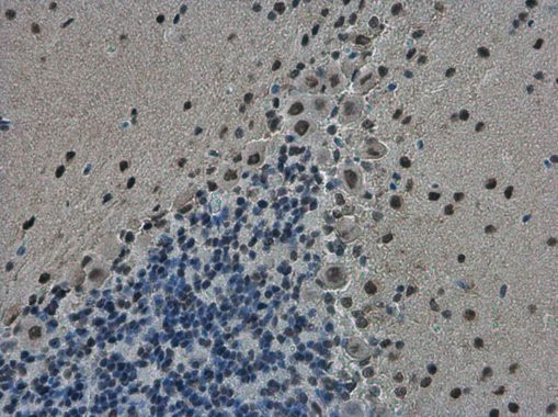 TDP-43 Antibody in Immunohistochemistry (Paraffin) (IHC (P))