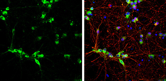 Syntenin 1 Antibody in Immunocytochemistry (ICC/IF)