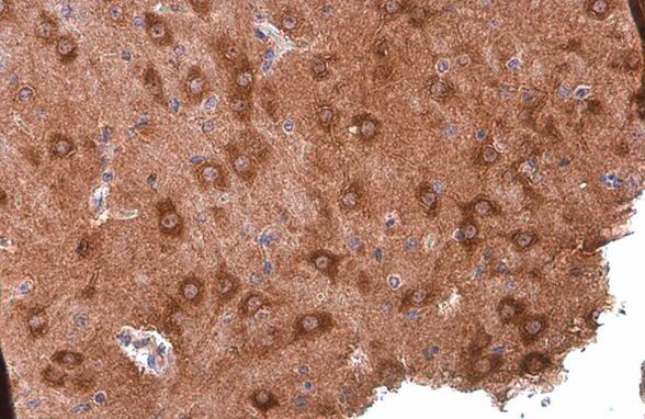 PYK2 Antibody in Immunohistochemistry (Paraffin) (IHC (P))